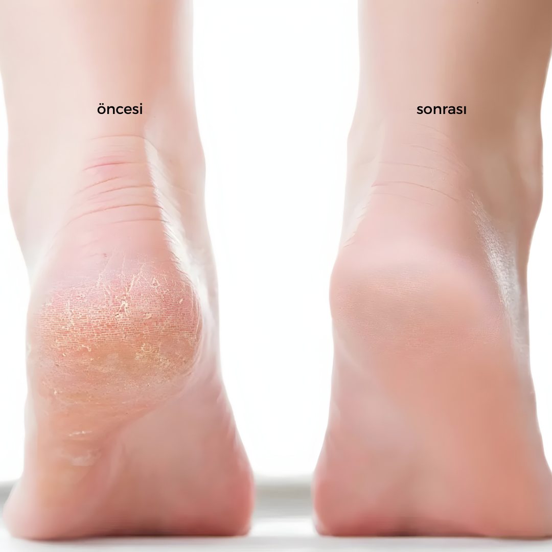 MONICA AURA-SmoothFeet