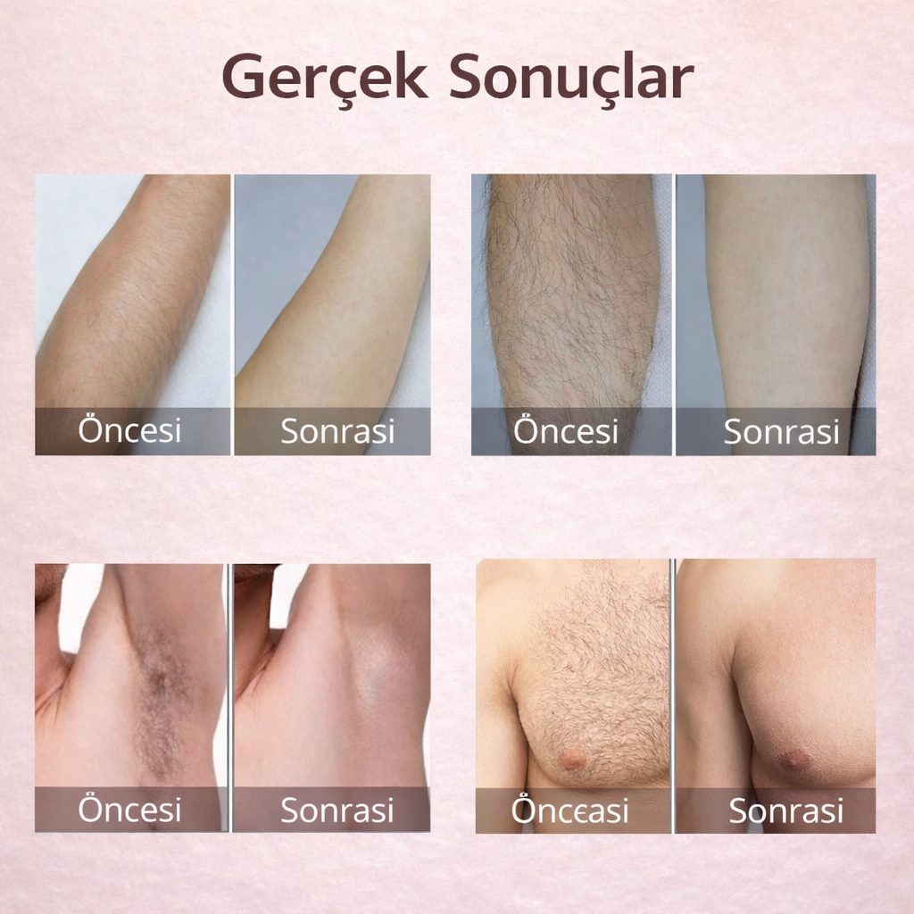 MONICA AURA-SilkSkin