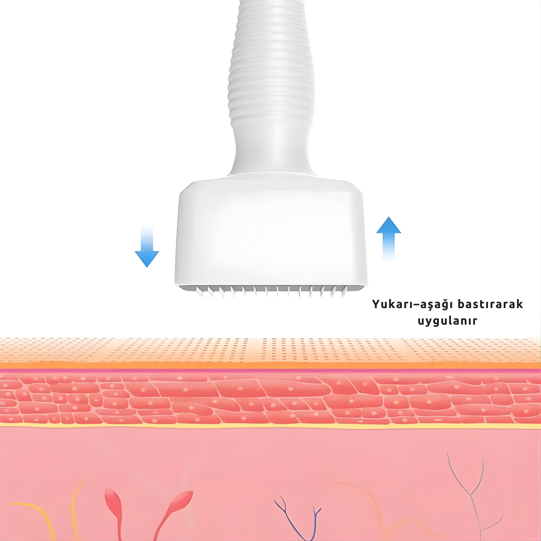 MONICA AURA-MicroStamp 140A