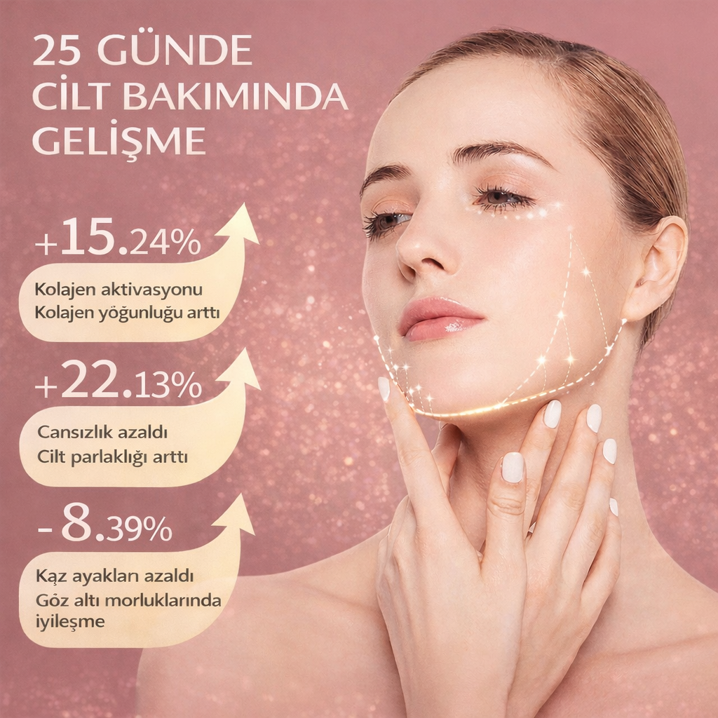 MONICA AURA-V-Face Lift