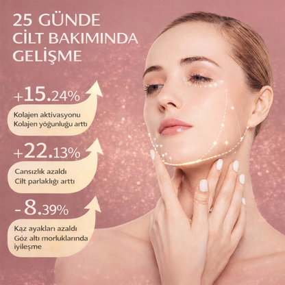 MONICA AURA-V-Face Lift