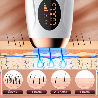 MONICA AURA-SilkSkin