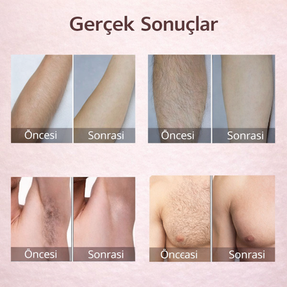 MONICA AURA-SilkSkin