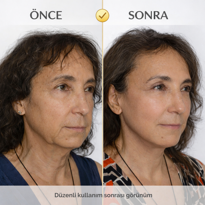 MONICA AURA-AuraLight Facial Pro