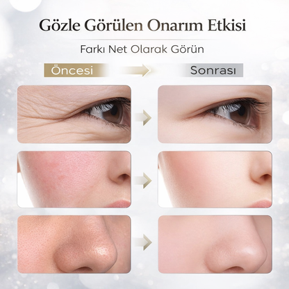 MONICA AURA-LumiMask