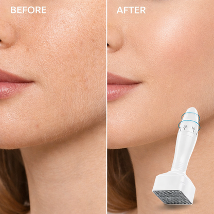 MONICA AURA-MicroStamp 140A