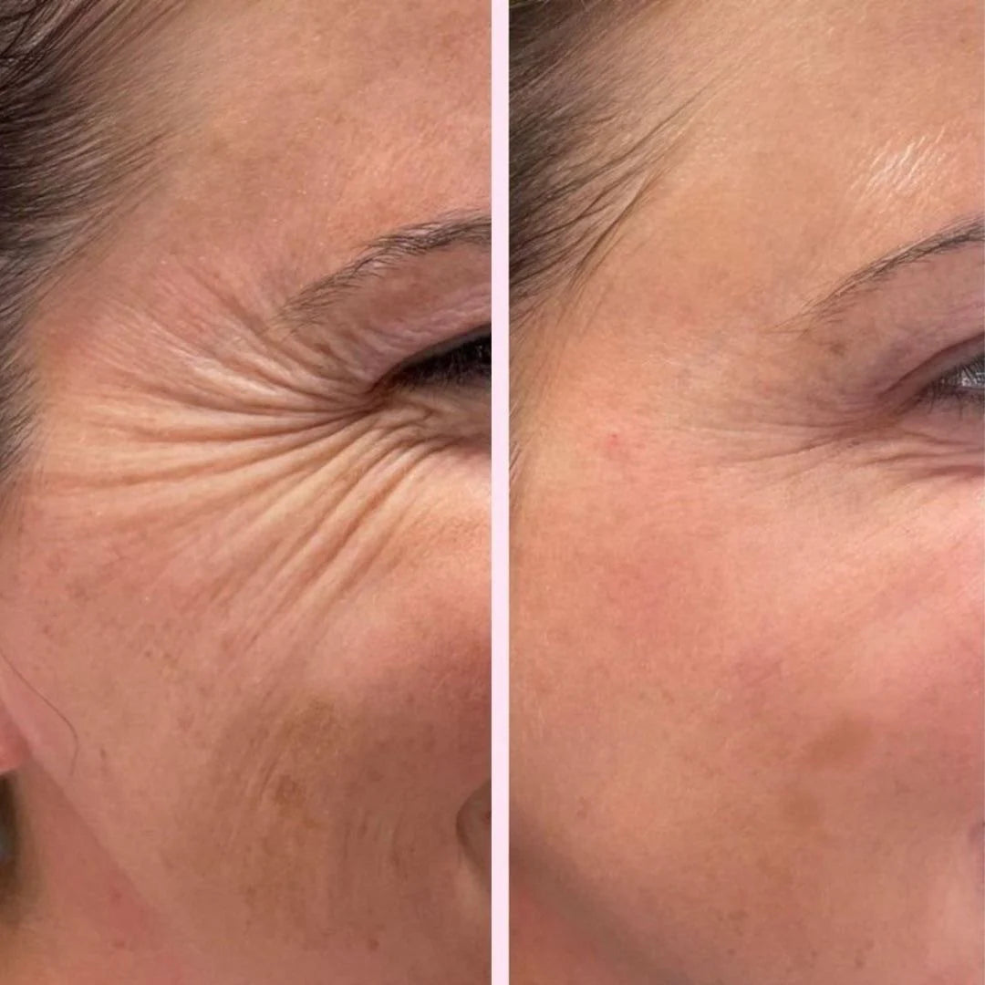 Monica Aura-Kolejen Bant