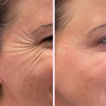 Monica Aura-Kolejen Bant