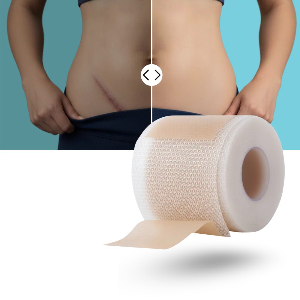 Monica Aura-Kolejen Bant