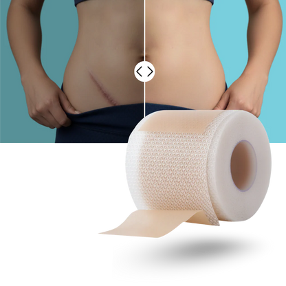 Monica Aura-Kolejen Bant