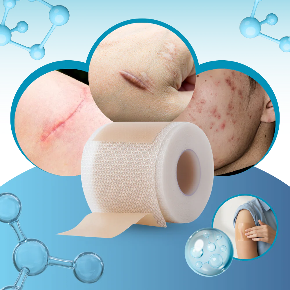 Monica Aura-Kolejen Bant